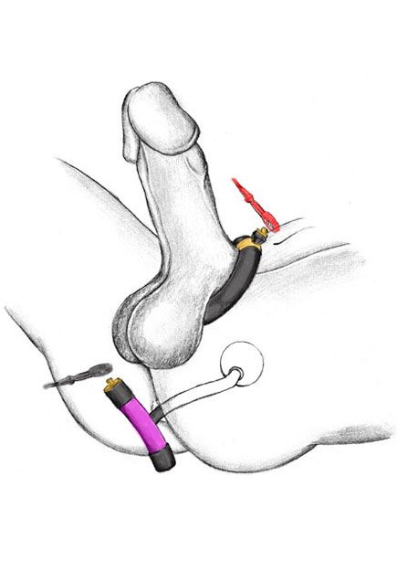 Électrode Tubulaire de Base 