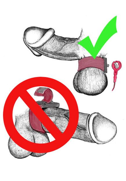 Scrotum Electrode